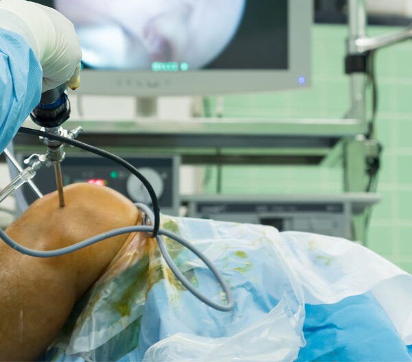 Chirurgie du genou
