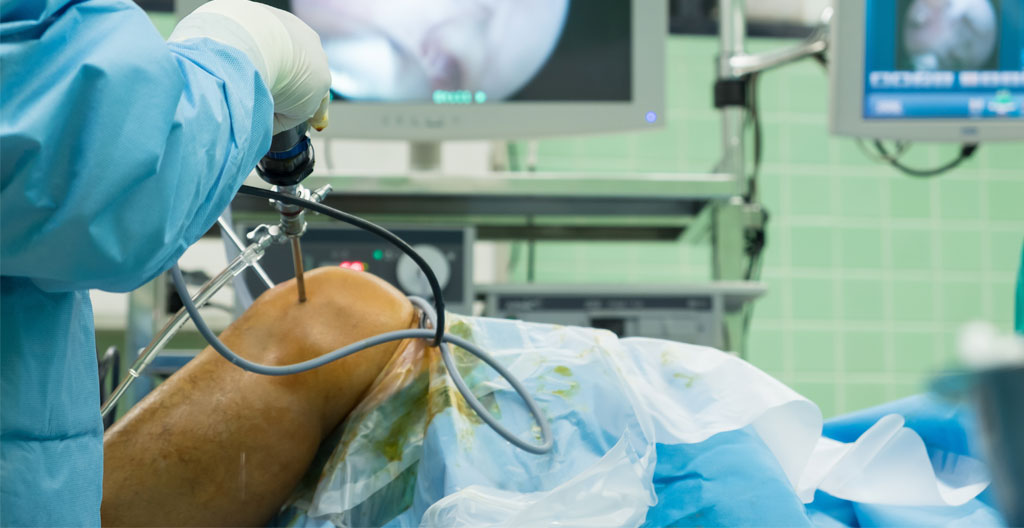Chirurgie du genou